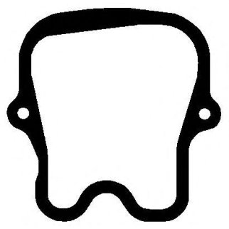 Прокладка клапанной крышки Elring 638.901 фото