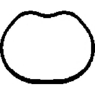 Прокладка впускного коллектора фото